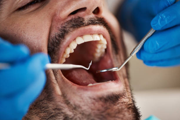 Best Emergency Treatment for Toothache in Wrightsville, GA